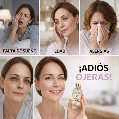 ANTIOJERAS ISERA! Mirada Más Joven, Ilumina y Revitaliza tu Mirada.